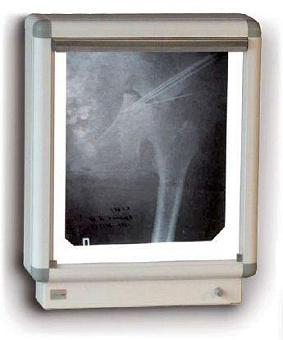 Негатоскоп флюоресцентный на один снимок