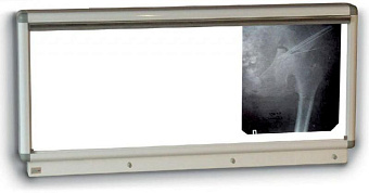 Негатоскоп флюоресцентный на три снимка