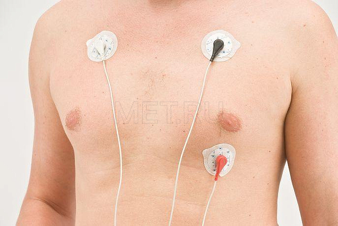  Электрокардиограф " АРМЕД " PC-80A MET