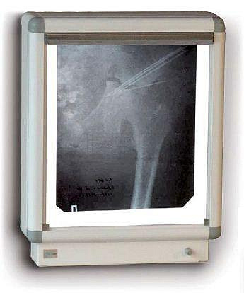 НМ-1 Негатоскоп флюоресцентный на один снимок