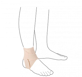 Ортез на голеностопный сустав