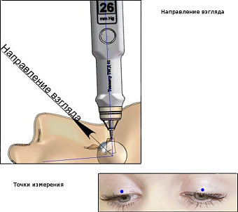 Бесконтактный офтальмологический тонометр